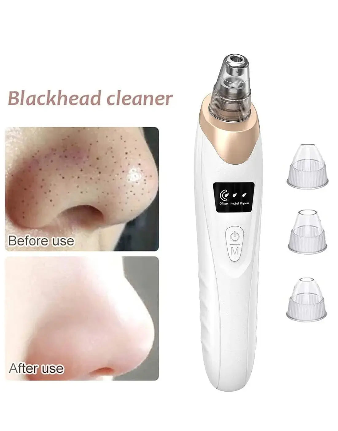 5-in-1 Electric Blackhead Remover & Pore Vacuum – Facial Skin Cleaner