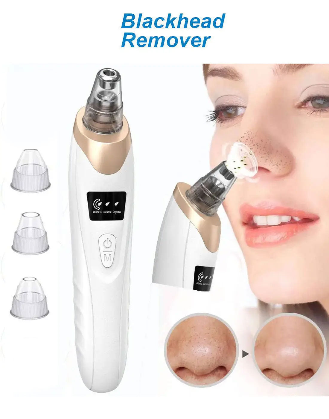 5-in-1 Electric Blackhead Remover & Pore Vacuum – Facial Skin Cleaner