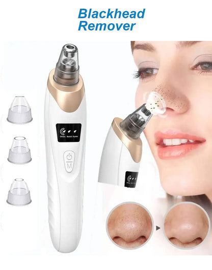 5-in-1 Electric Blackhead Remover & Pore Vacuum – Facial Skin Cleaner