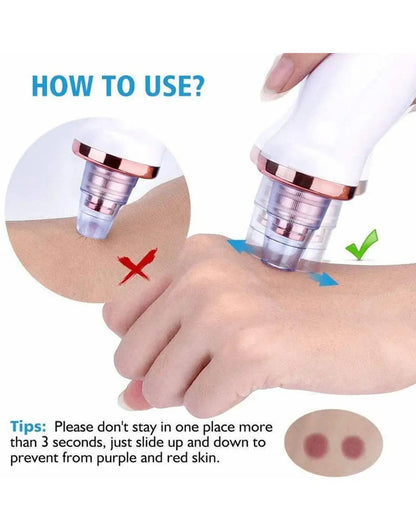 5-in-1 Electric Blackhead Remover & Pore Vacuum – Facial Skin Cleaner